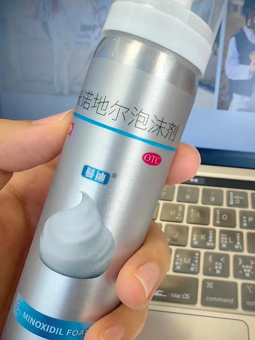 专业生发解决方案:米诺第二代蔓迪生发泡沫剂,科学助力头发再生